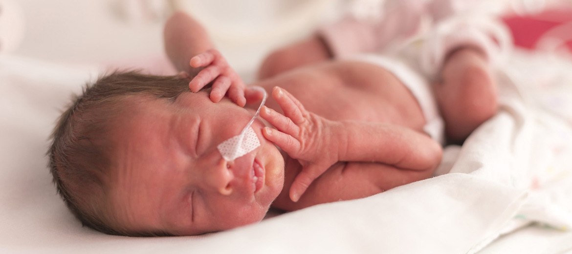 photo of premature baby in humidicrib